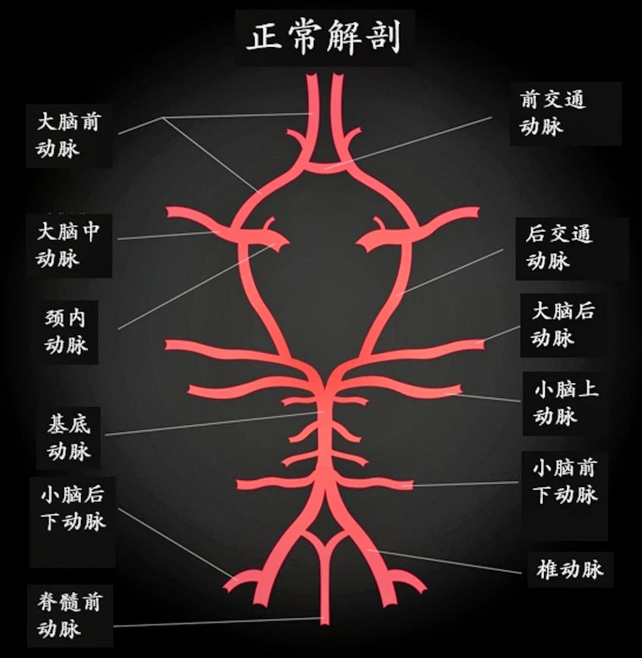 acha血管图片