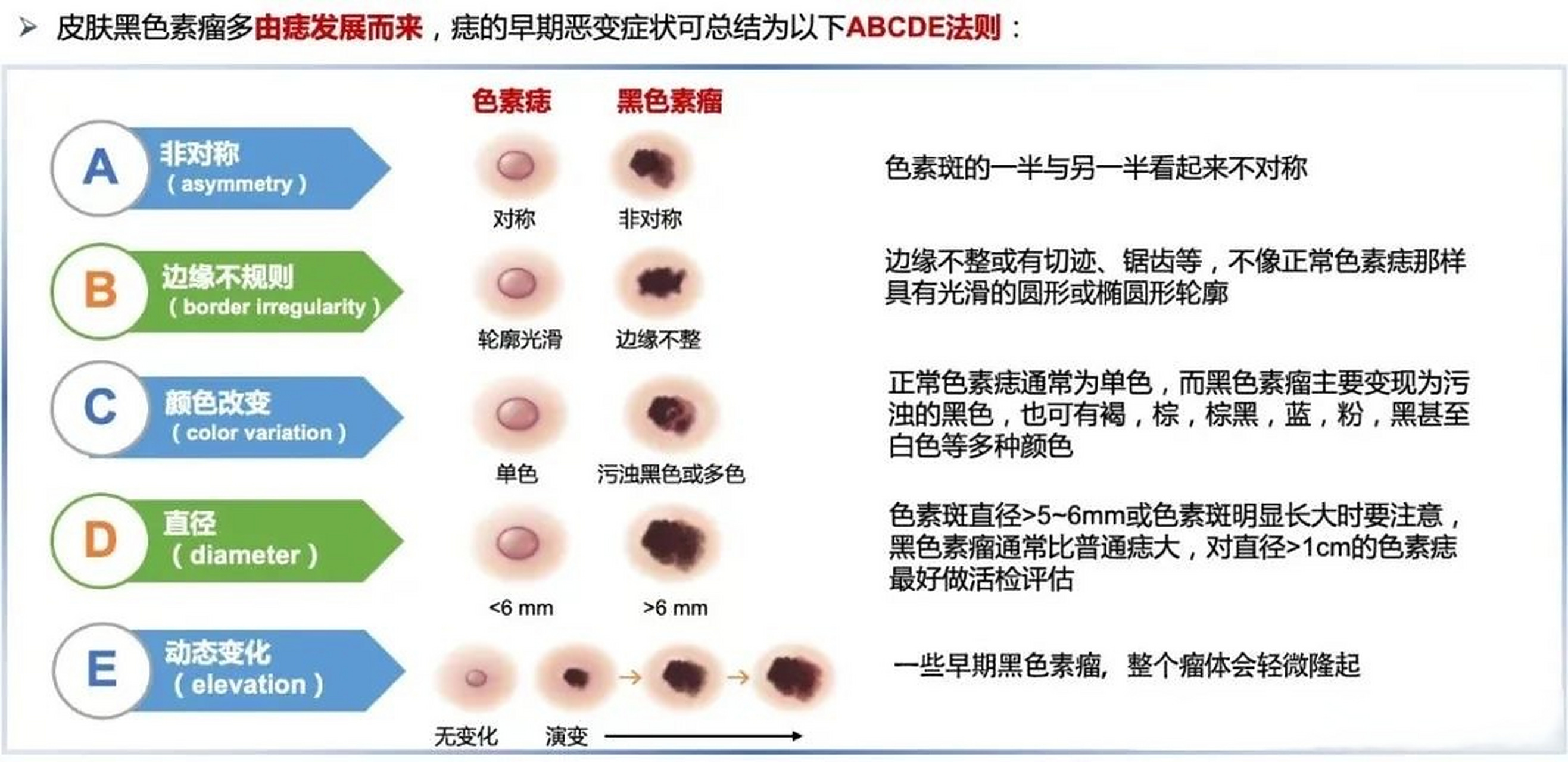 好声音学员张恒远因黑色素瘤去世,一张图教你黑色素瘤和痣怎么区分!