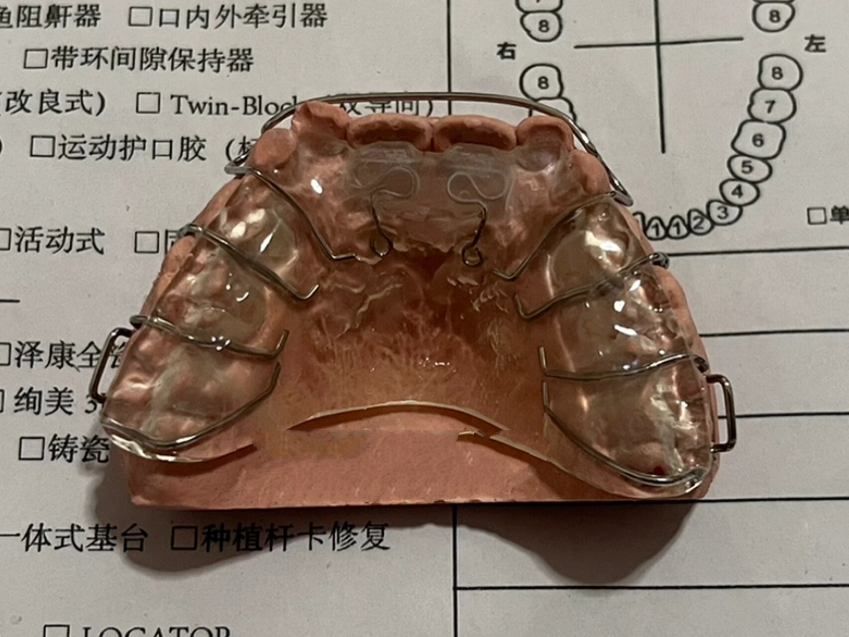 儿童地包天——反颌颌垫推簧矫治器❗️ 上颌颌垫推簧矫治器戴用