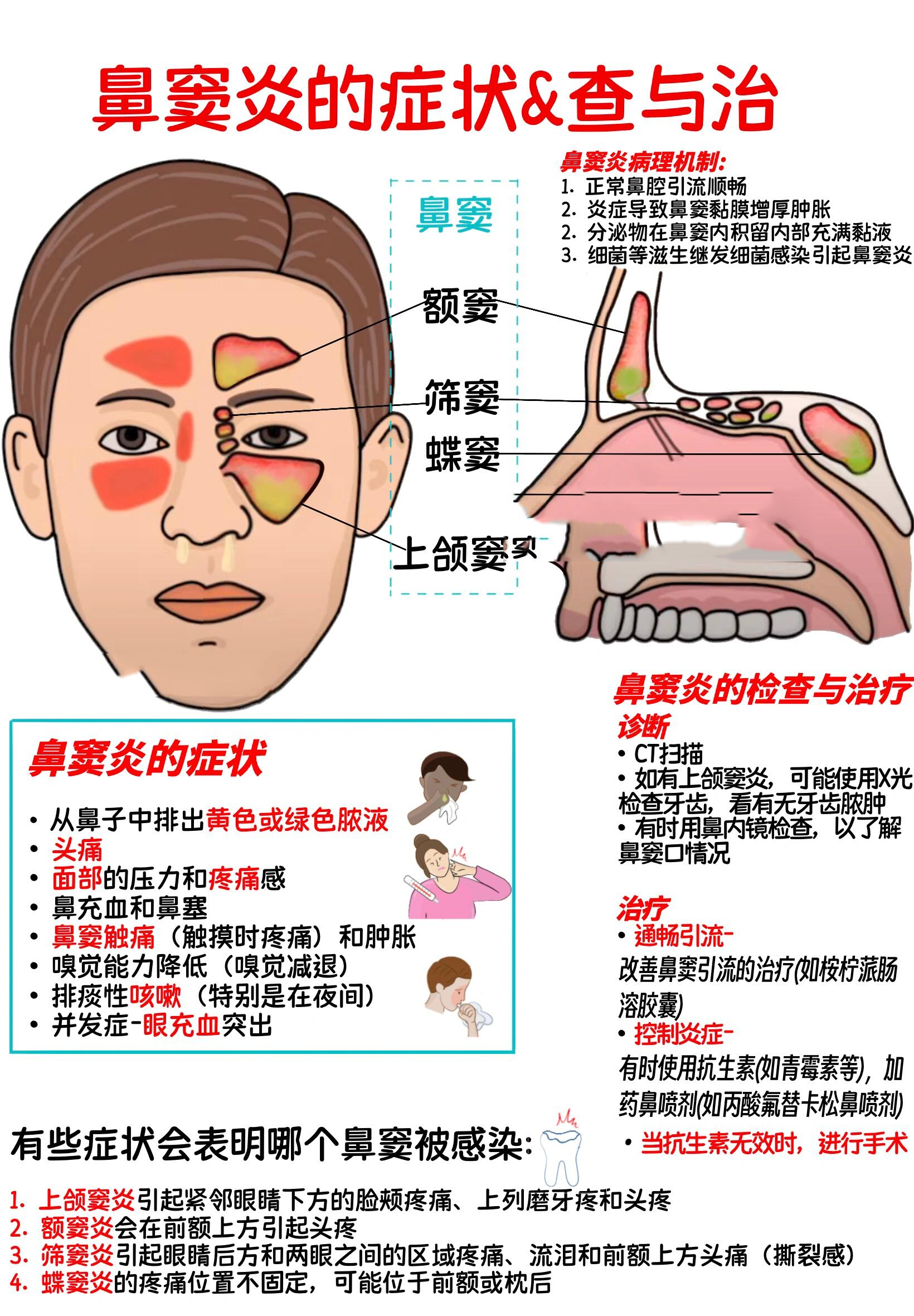 鼻旁窦的名称位置图图片