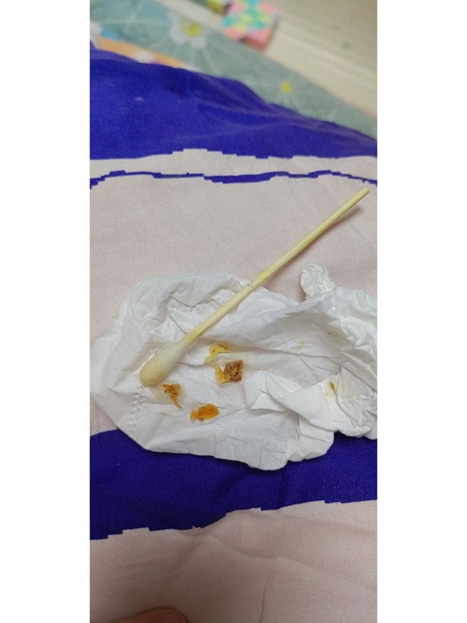 大宝四岁了一直没敢掏耳屎,最近发现耳朵深处有好大一坨硬耳屎,耳汉