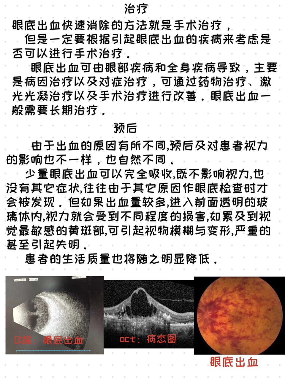 眼底出血 眼底出血,与看到的眼白出血是不同的.造成的损害更大.