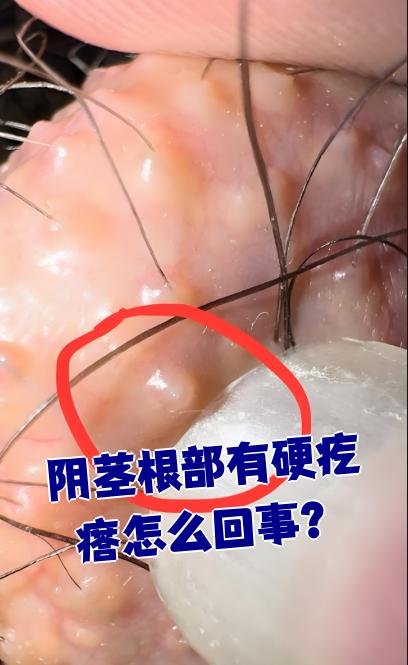 阴茎为什么越来越小