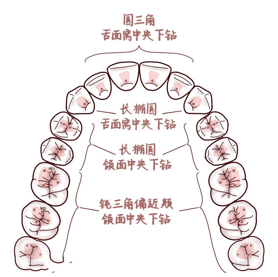 侧切牙位置图片