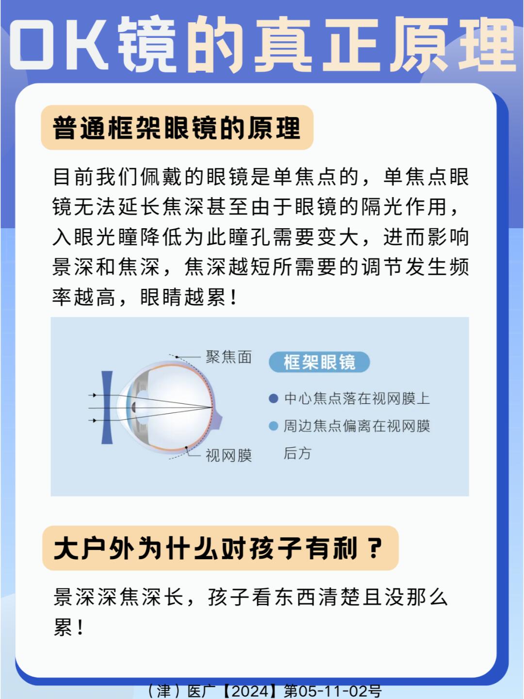 是通过离焦环的近视离焦作用控制眼轴向