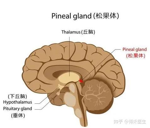 松果体囊肿的危害图片