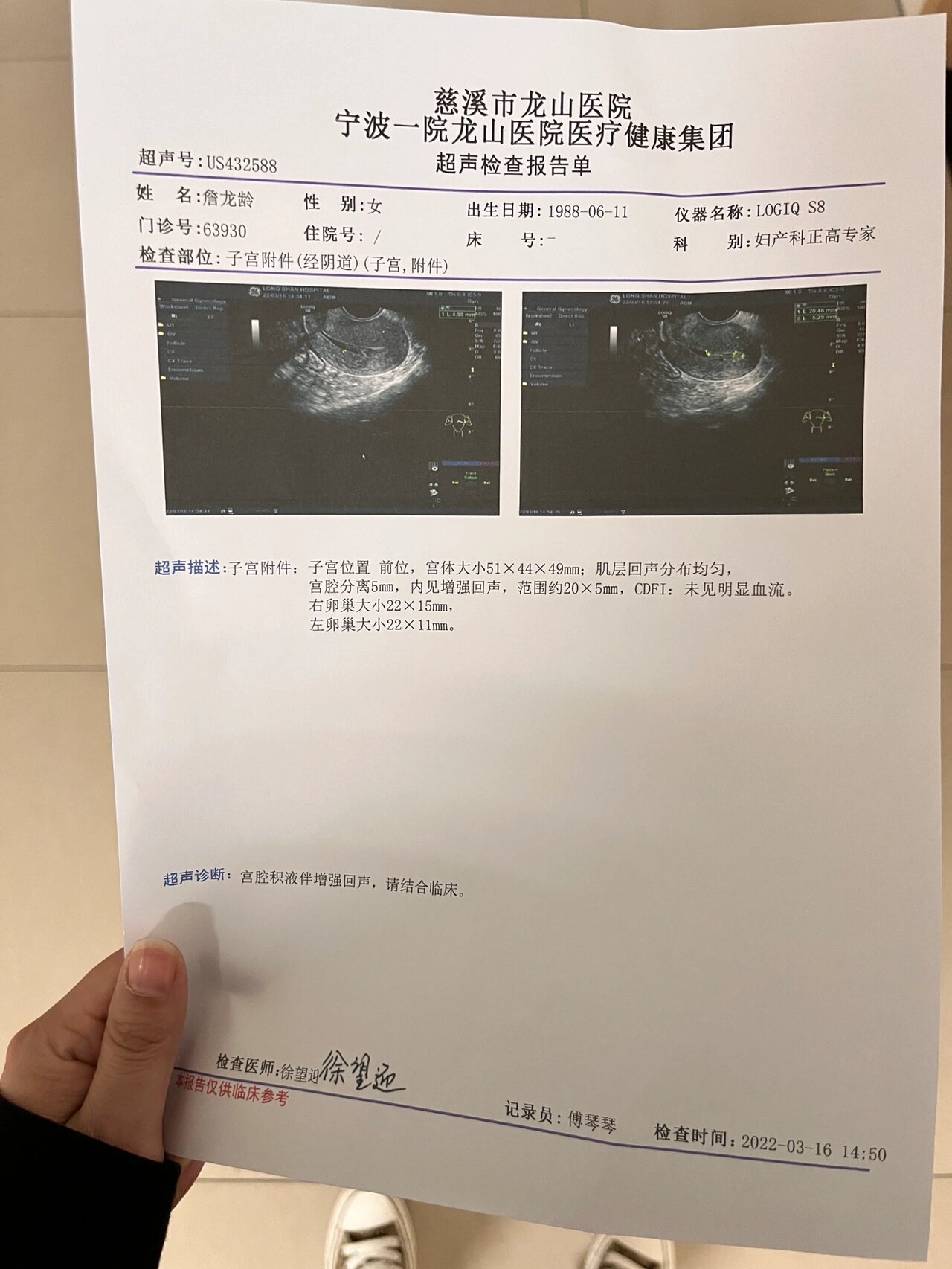 人流第8天