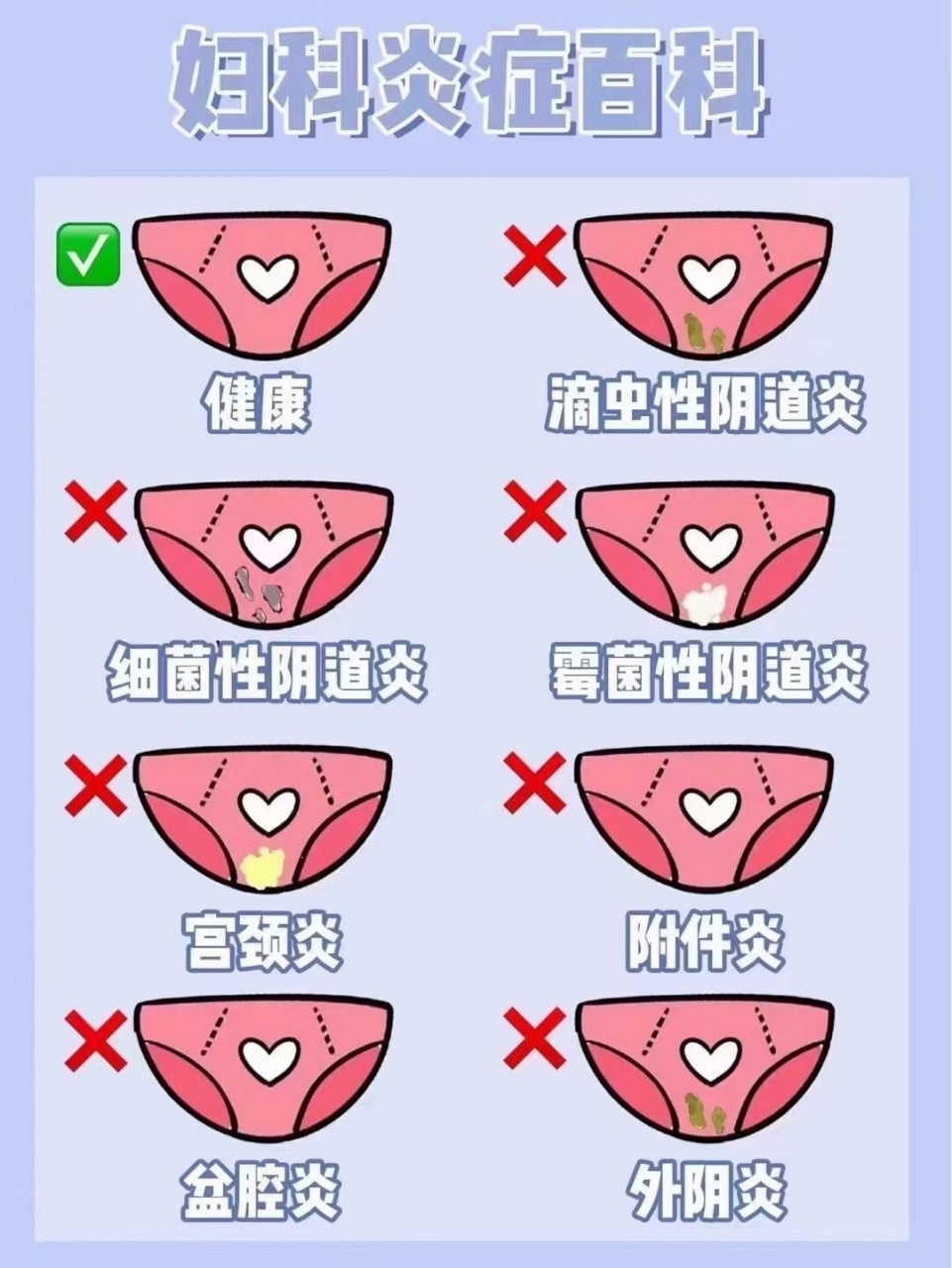 99%女生都忽略的私处 看完这三幅图你就明白了 99%女生都忽略的私处