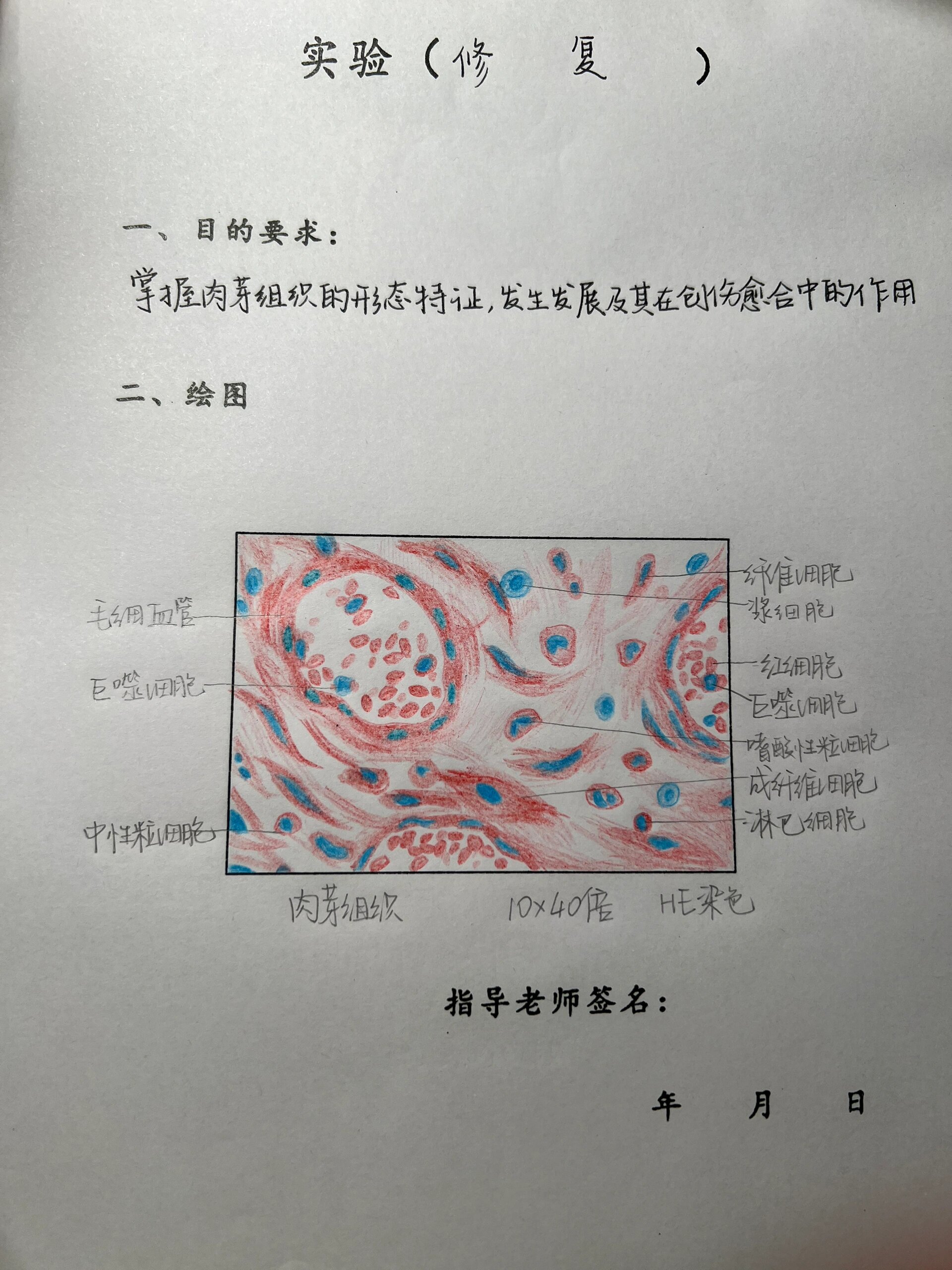 肉芽组织红蓝铅笔图图片