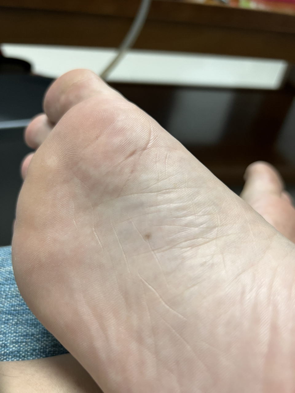 脚底长痣有啥事吗 一个新长的一个一直有 左边脚心不知道啥时候长的