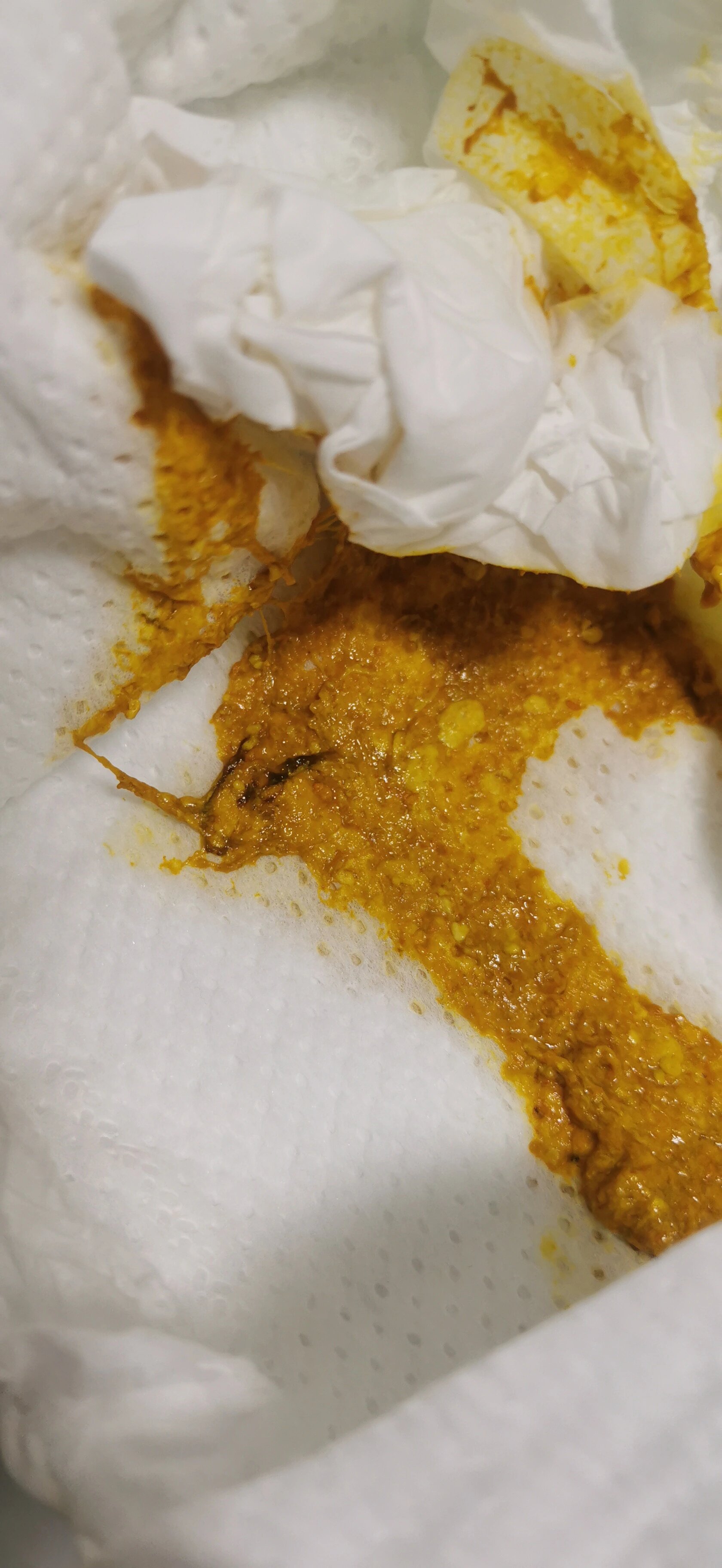 50天的婴儿便便有褐色条状物