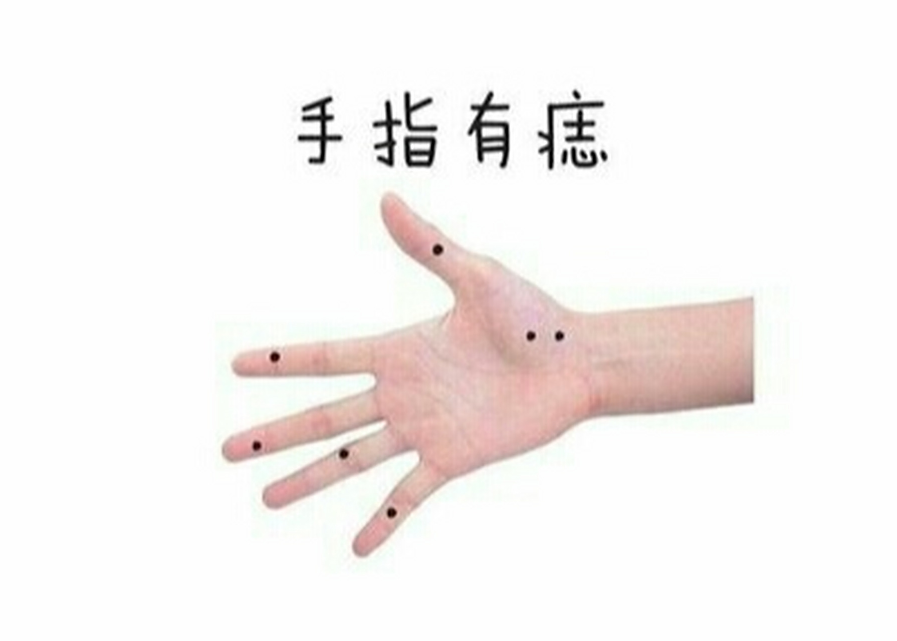 手指有痣好不好呢?