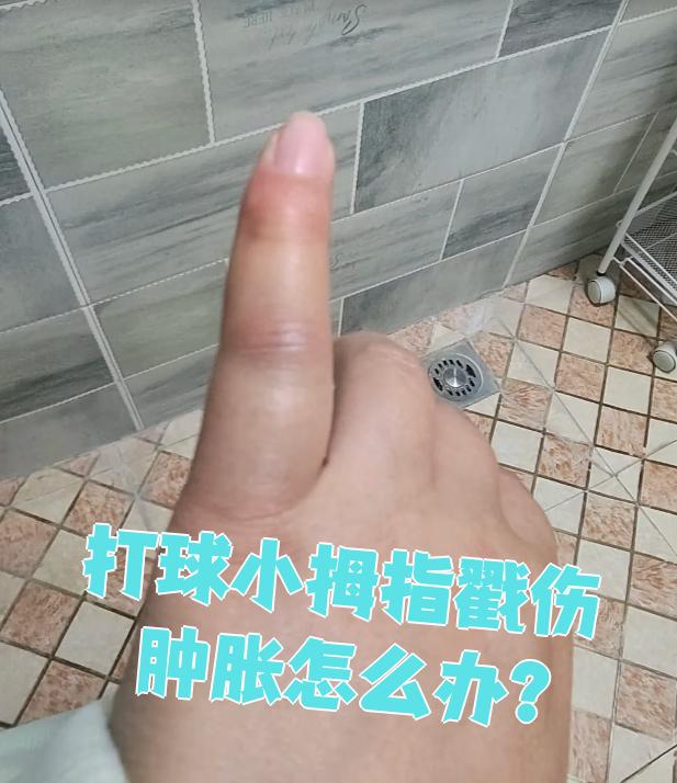 打球小拇指戳伤肿胀怎么办?