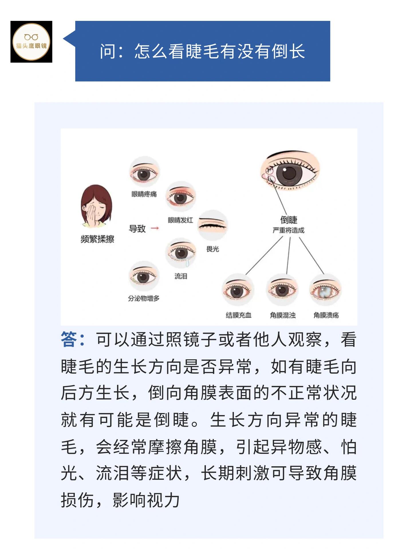 怎么看睫毛有没有倒长 可以通过照镜子或者他人观察,看睫毛的生长方向