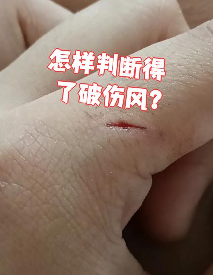 而且没好好清理伤口,也没打过破伤风抗毒素,就要特别注意