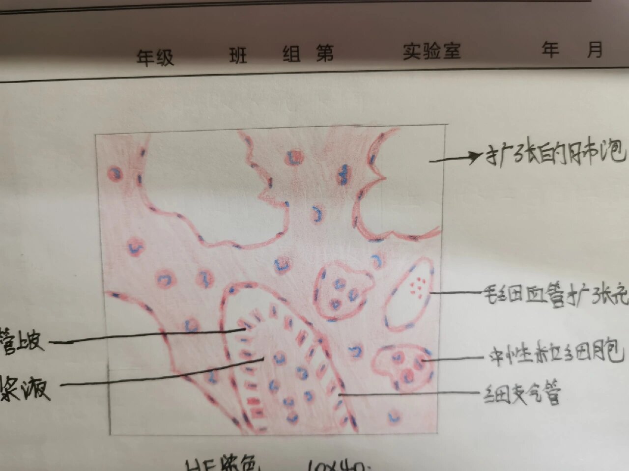 肺炎杆菌手绘图图片