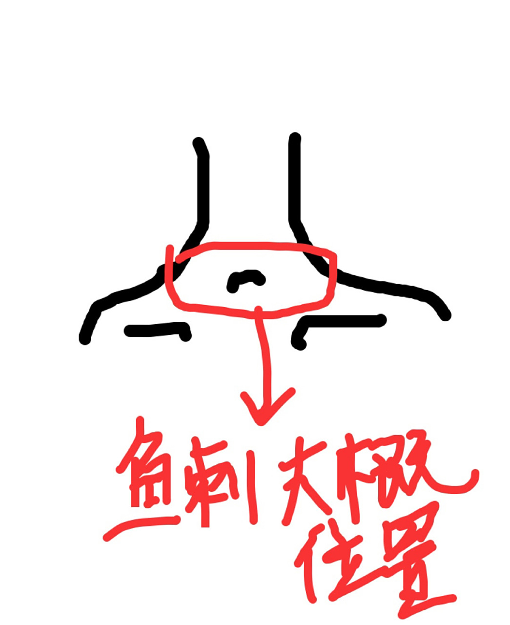 鱼刺卡入如图大概位置呼吸有些不顺畅 小红94的家人们,我被鱼刺卡住