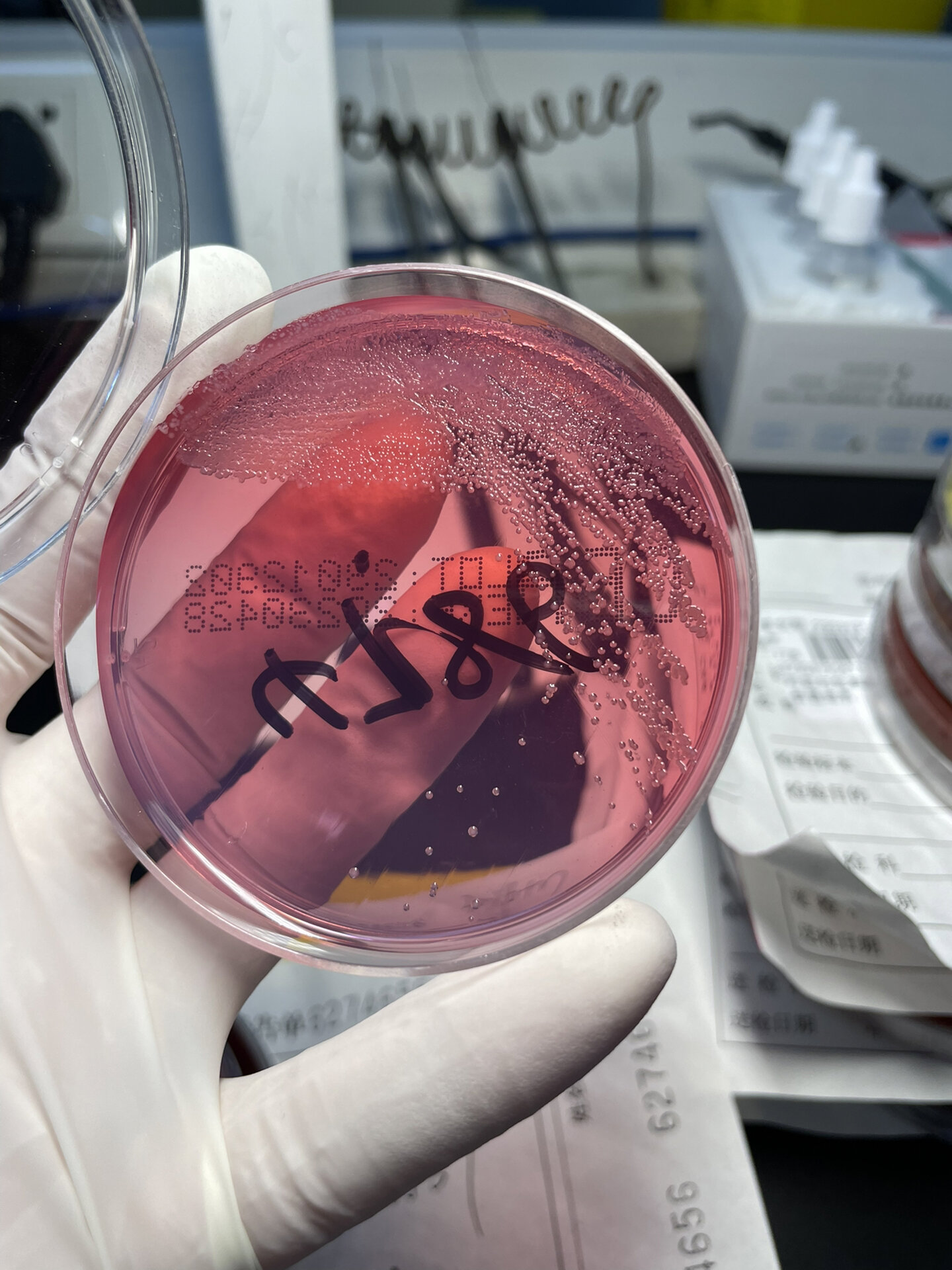 鲍曼不动杆菌 镜下革兰阴性杆菌