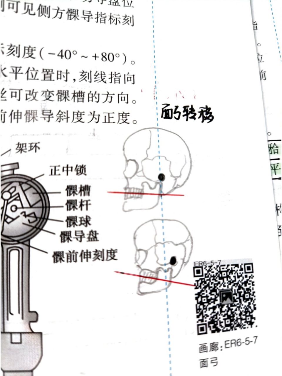 终于明白髁导斜度,切道斜度了