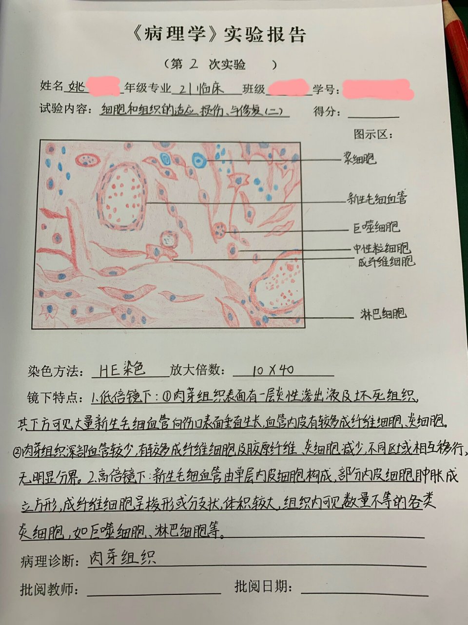 病理学肉芽组织图片