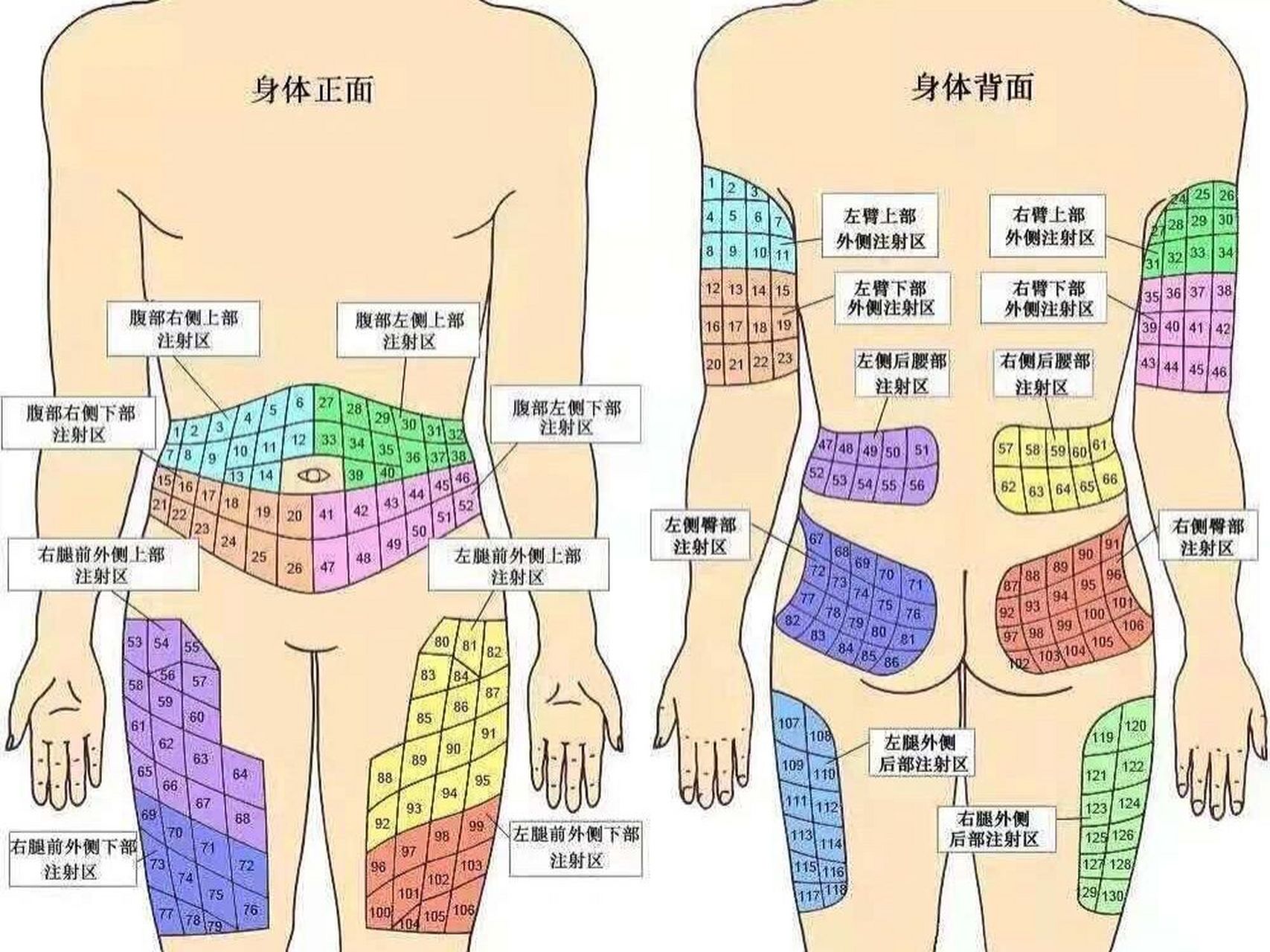 打胰岛素正确部位图图片