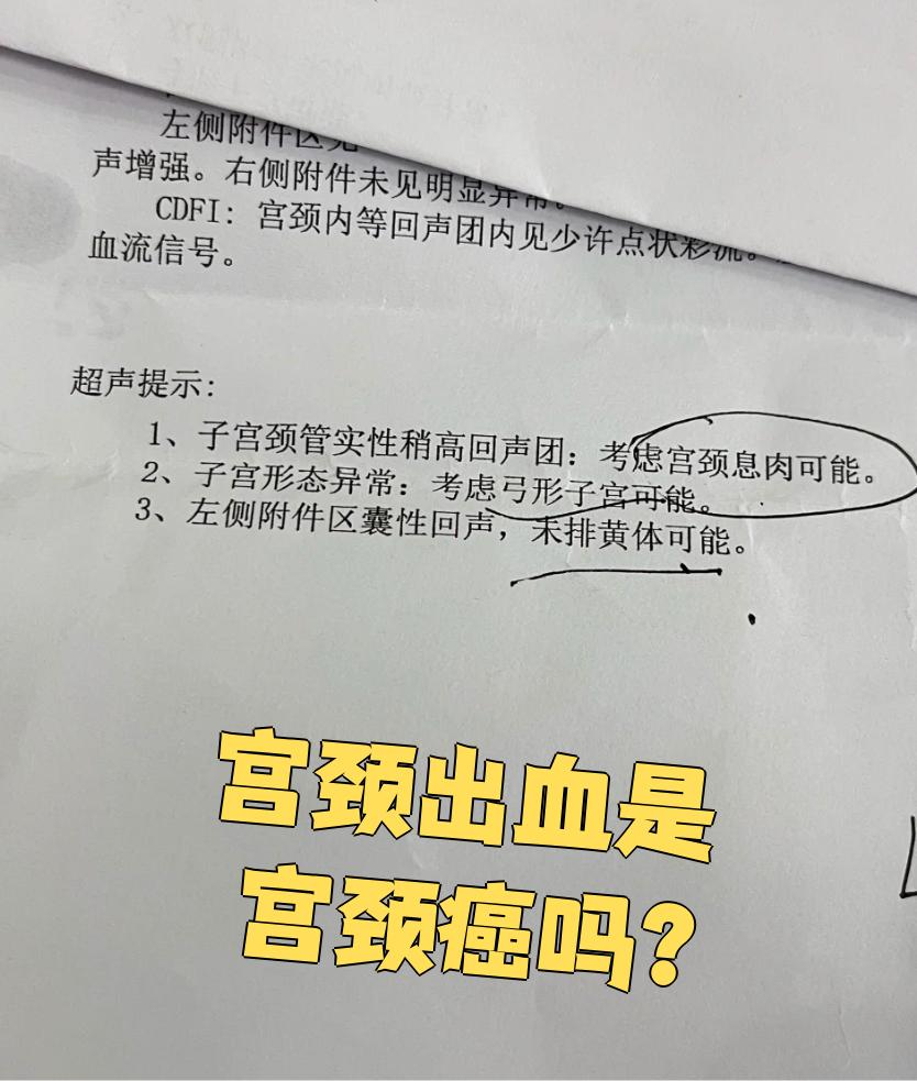 为什么检查宫颈会出血