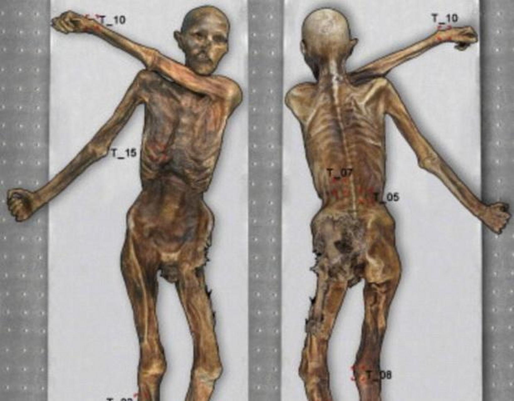 5300年前冰人奥茨发现新纹身:平行线条似针刺.
