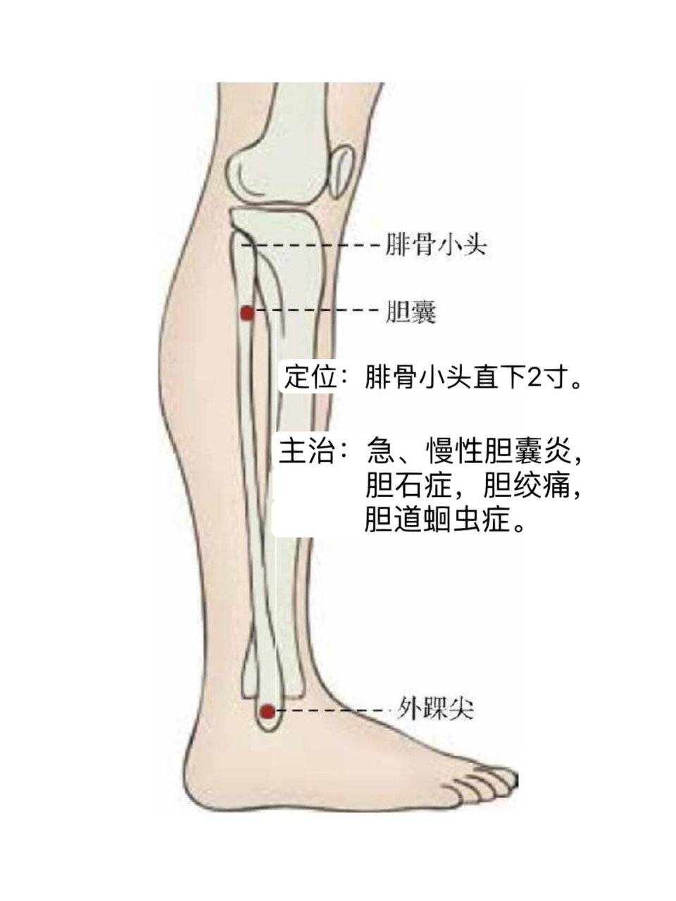 主治:急,慢性胆囊炎,胆石症,胆绞痛,胆道蛔虫症