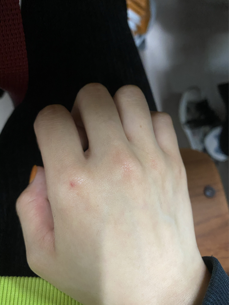 朱砂痣吗9898 好像是小时候长的 一直不知道是啥  也像一个小血点