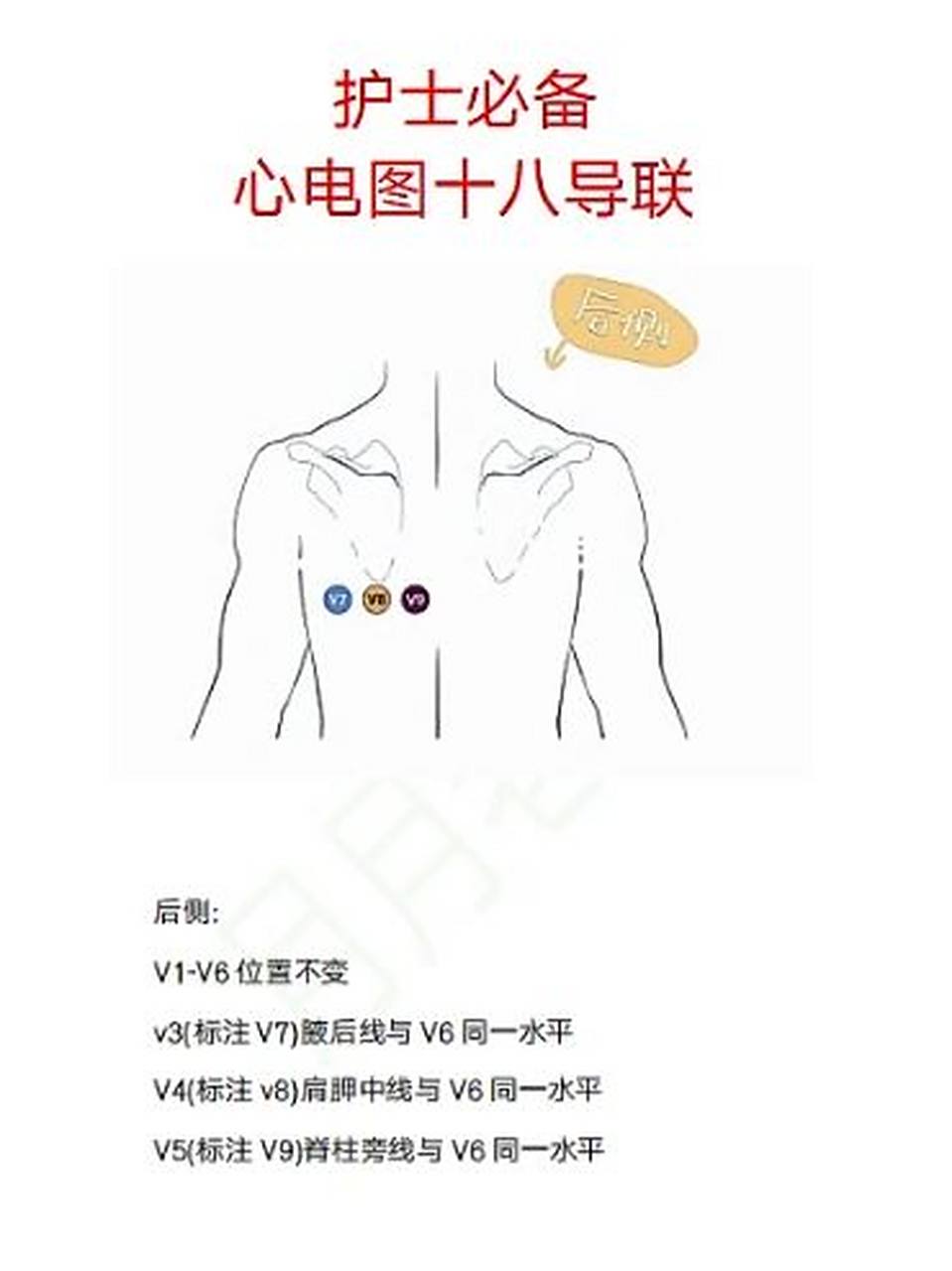 护士必备心电图十八导联