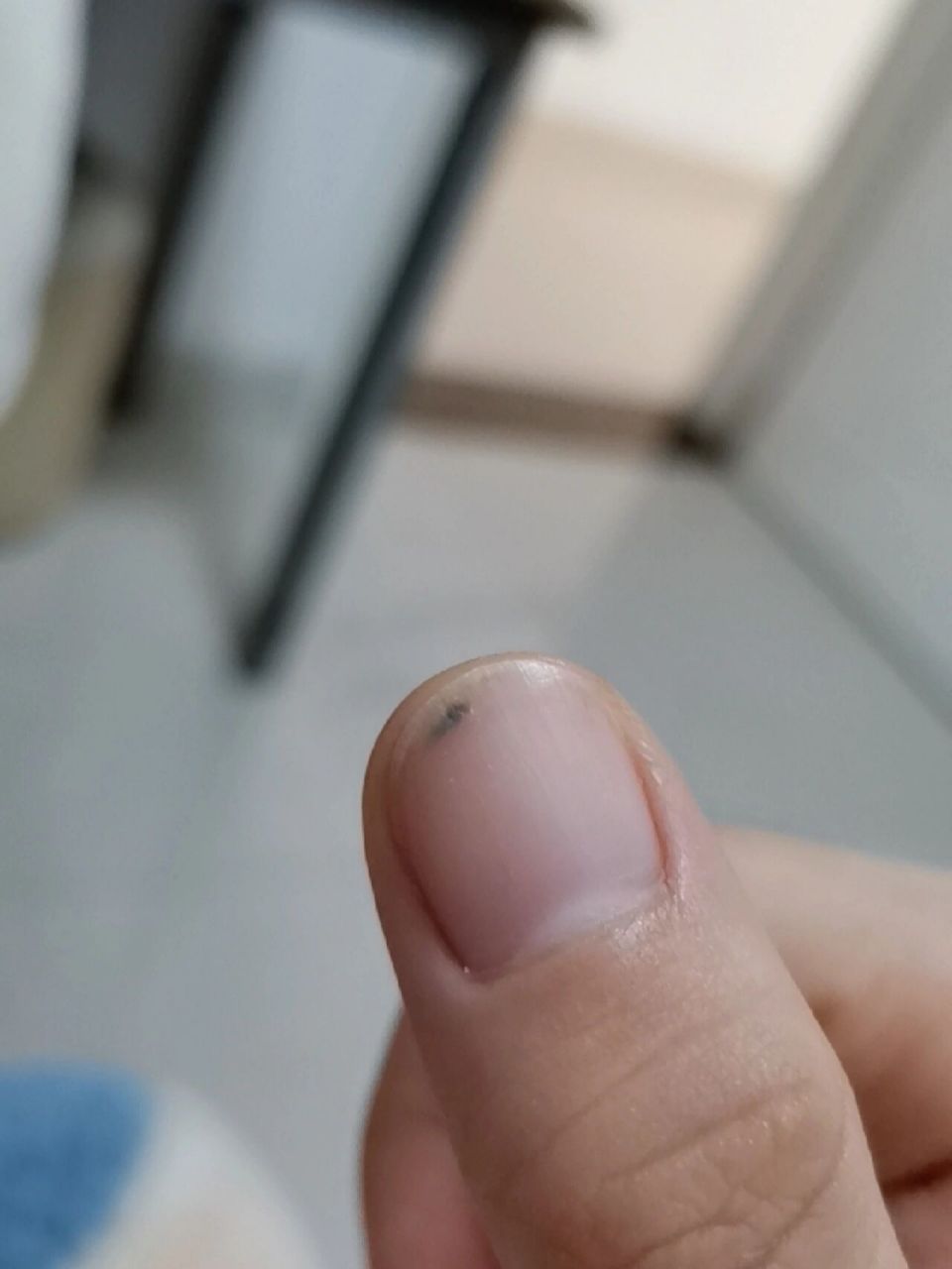 指甲缝卡东西怎么办 剥马蹄的时候皮卡在指甲里扣不出来了,怎么办啊