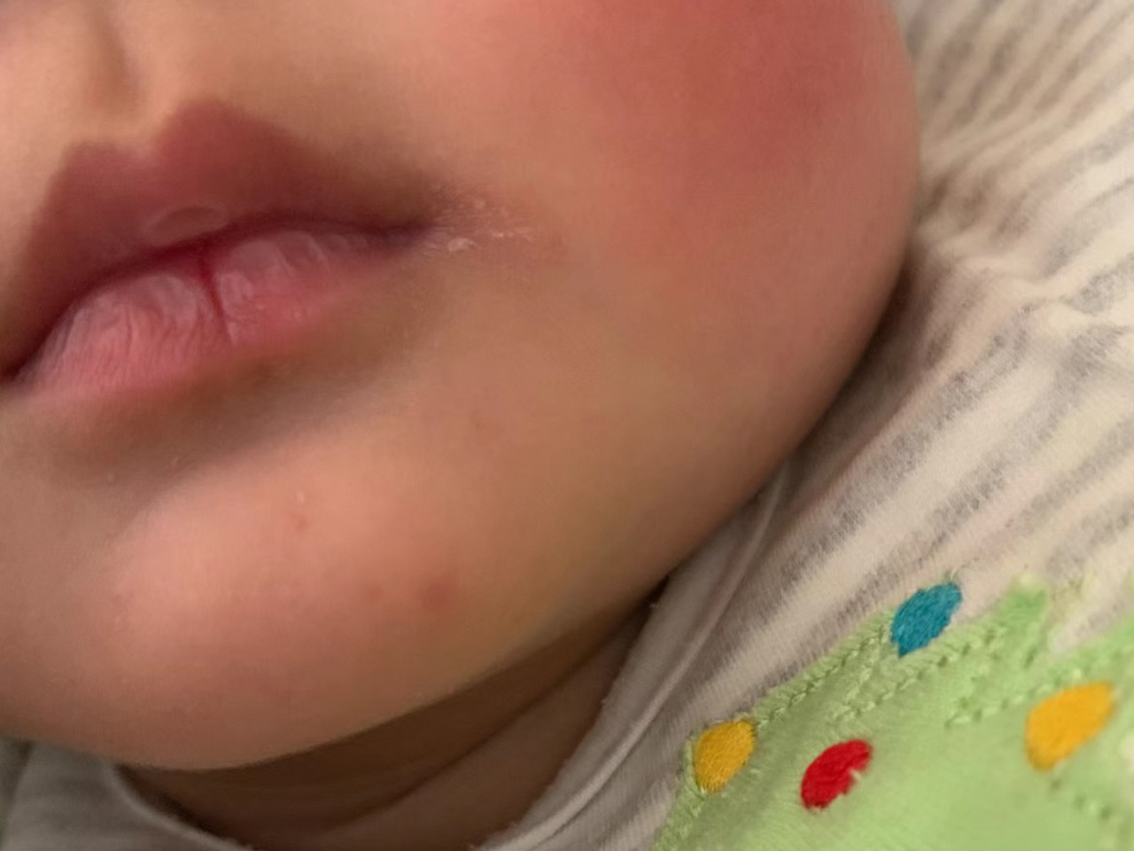 6个月的宝宝嘴唇干裂怎么办?