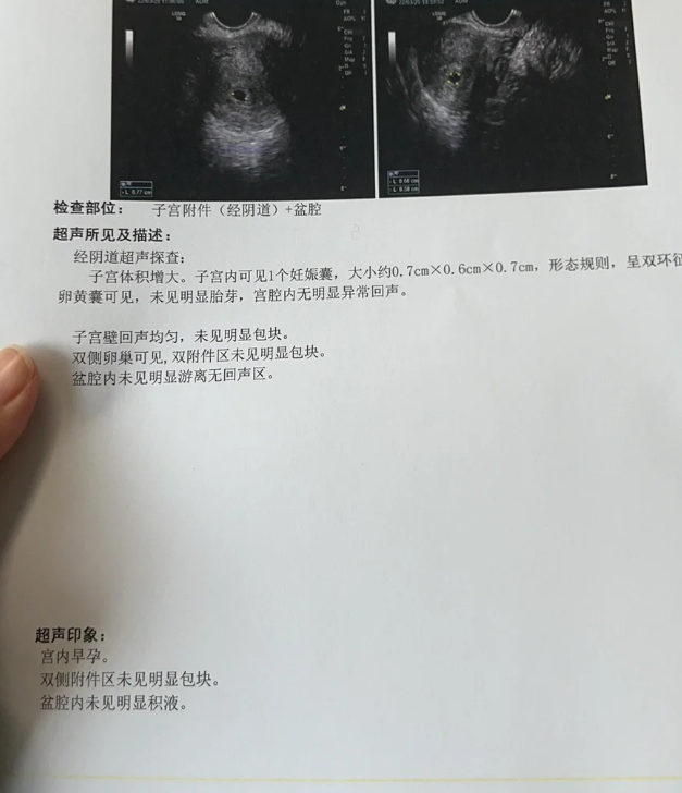 阴道b超能不能查出怀孕,要看具体情况