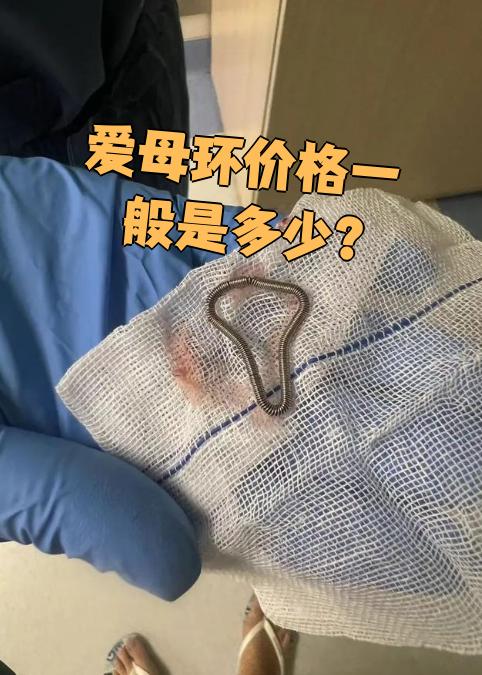 爱母环是专门用于女性长期避孕的宫内节育器,它有