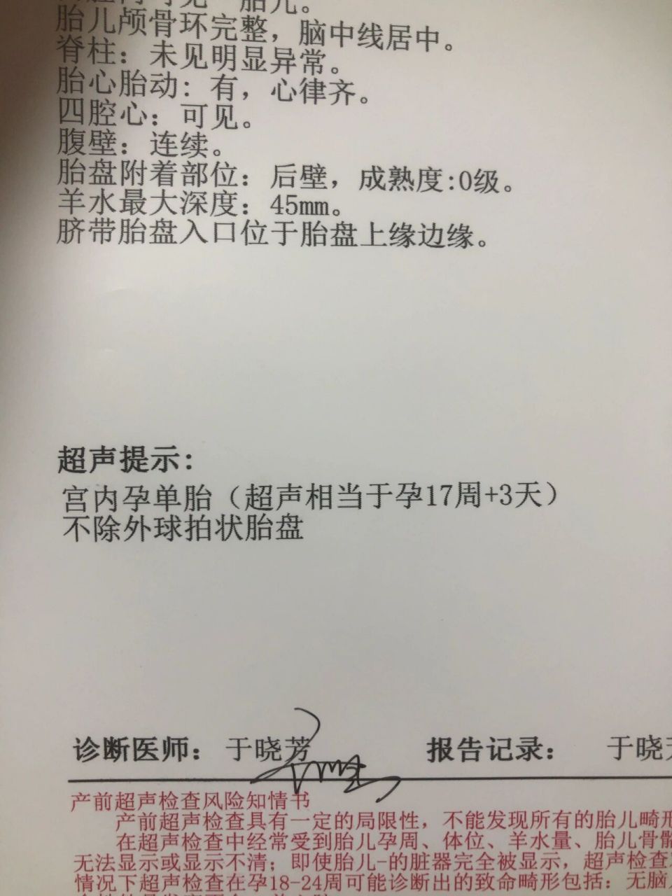 有球拍状胎盘的姐妹嘛