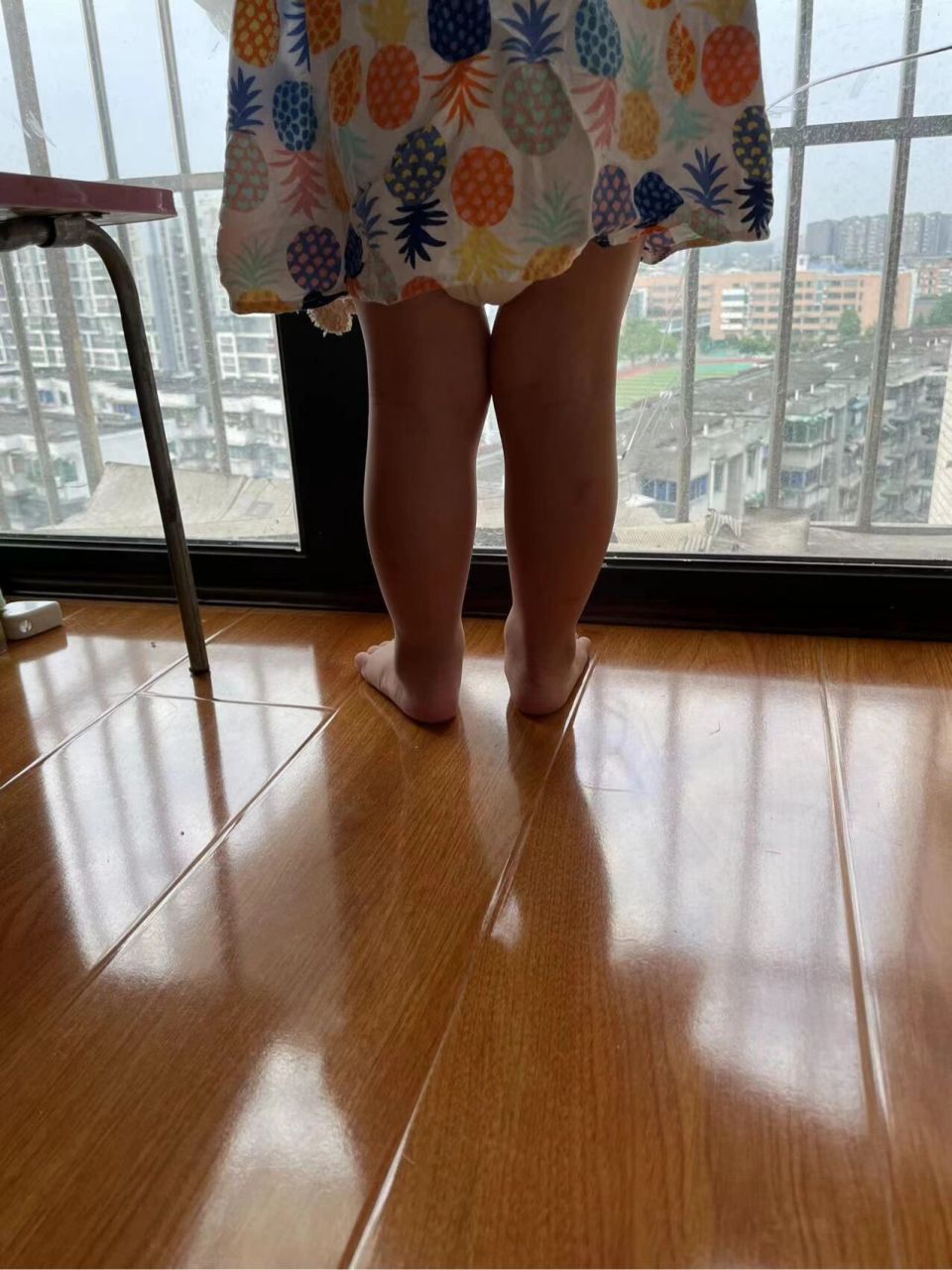 今天早上小朋友在飘窗上玩,突然发现这个腿型好像不对,她平时走路,跑