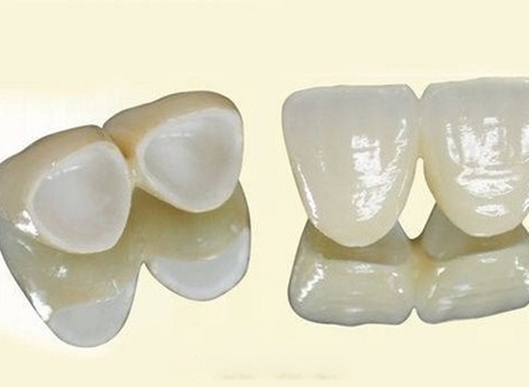 [话筒][话筒][话筒]全瓷冠是一种牙冠材料,佩戴在牙齿上以后可以对