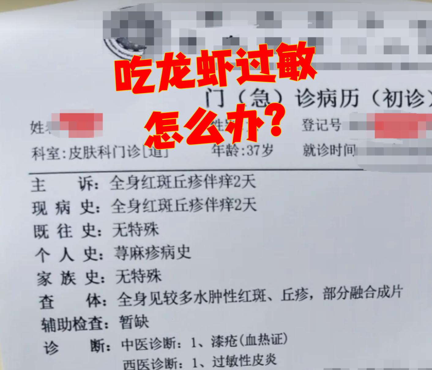 吃龙虾过敏怎么办?