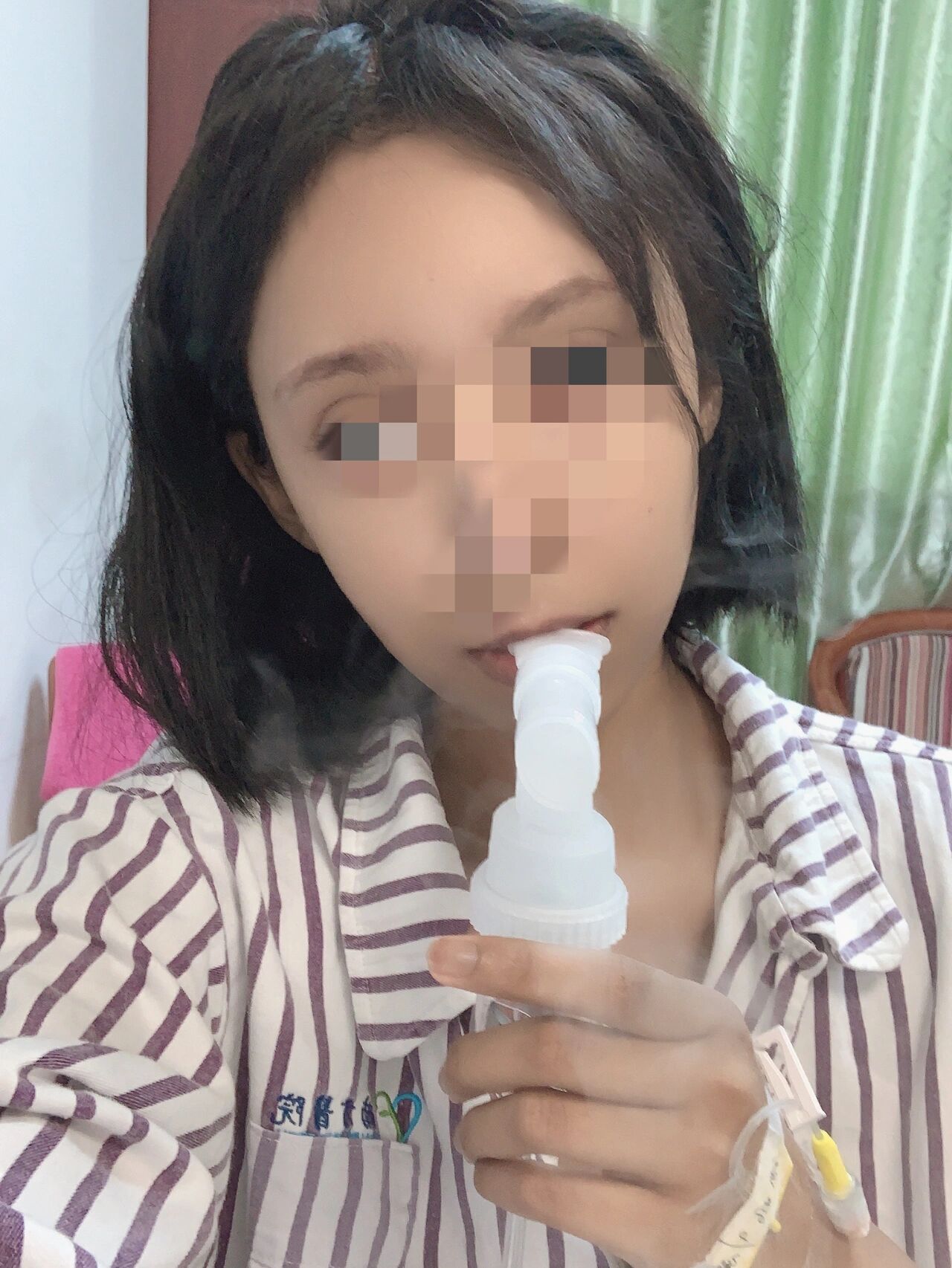 看看对比10斤加激素满月脸的对比 我就吃了两个月