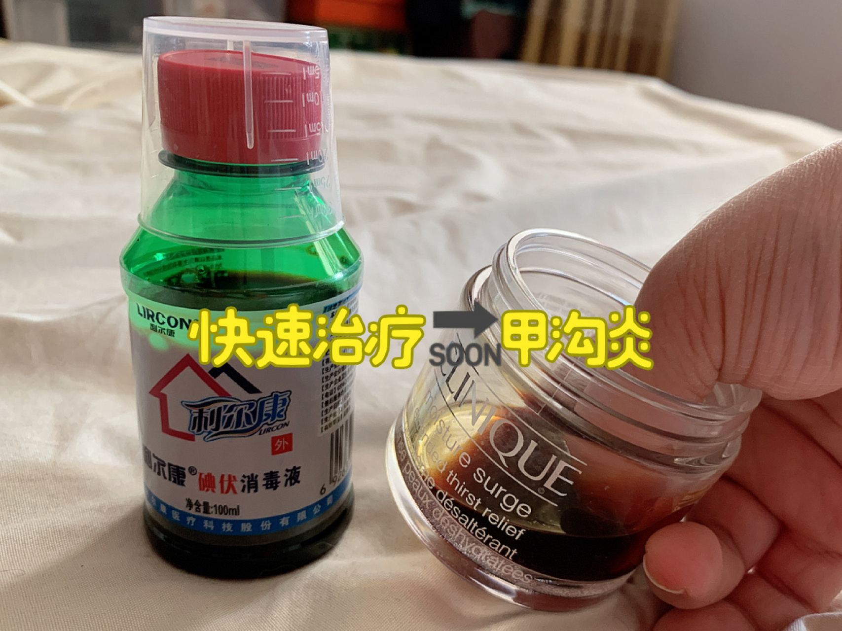 快速治疗甲沟炎! 碘伏 甲硝锉一周轻松治疗甲沟炎! ·什么是甲沟炎?