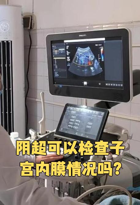 阴超可以检查子宫内膜情况吗?