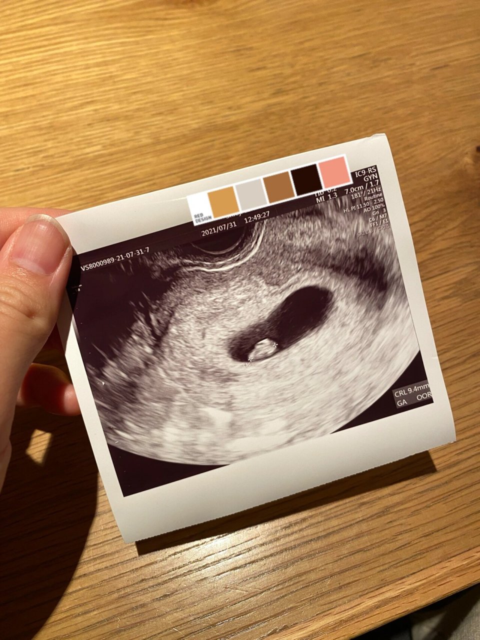 7周 3 胎心胎芽 今天去回诊有胎心胎芽啦!