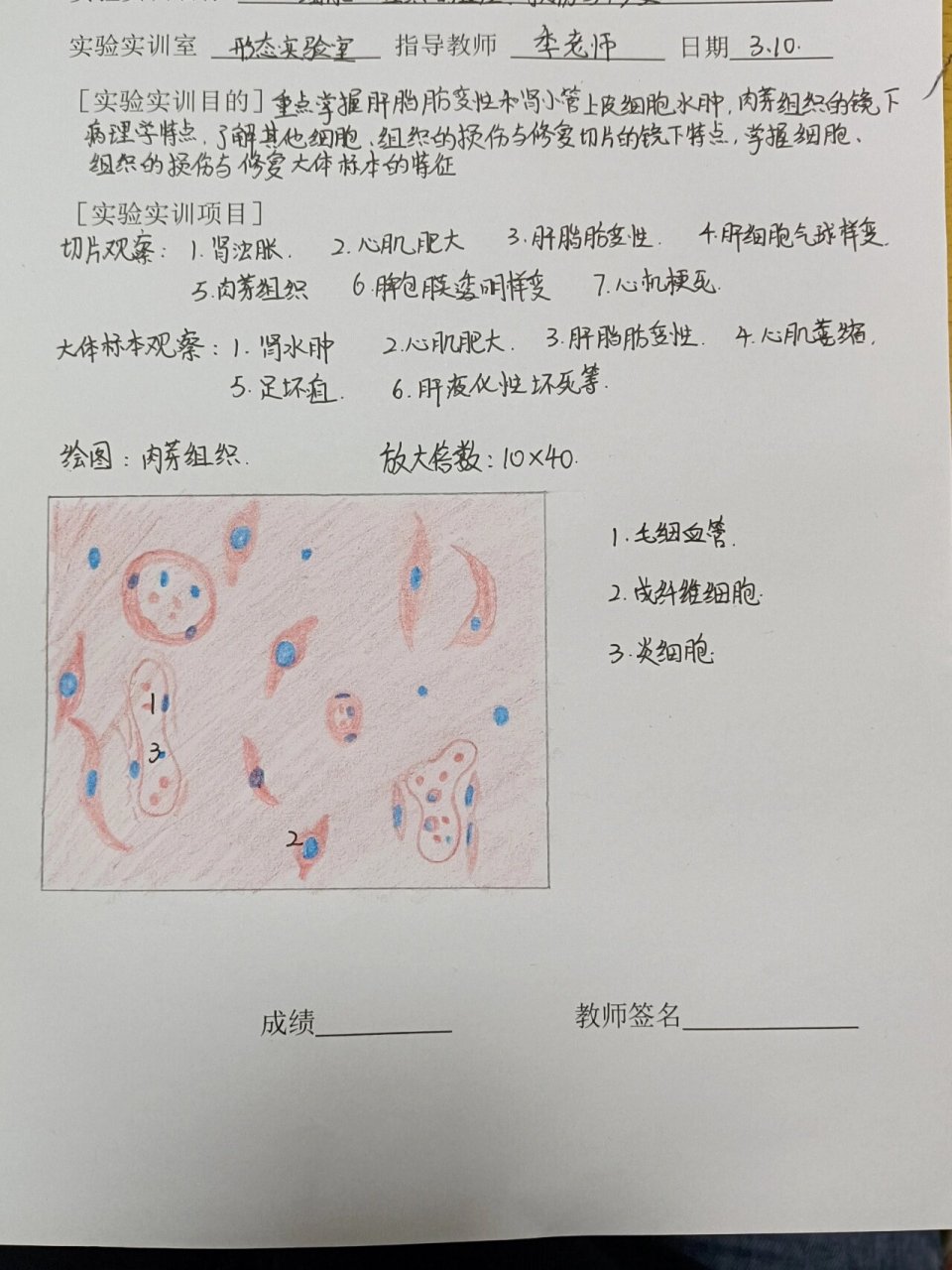病理学红蓝铅笔绘图 肉芽组织