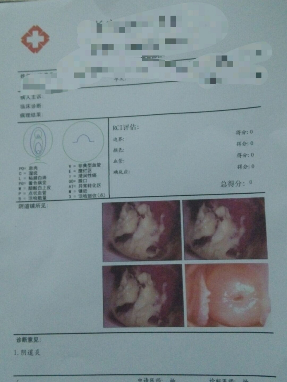 白带脓状发黄怎么回事图片