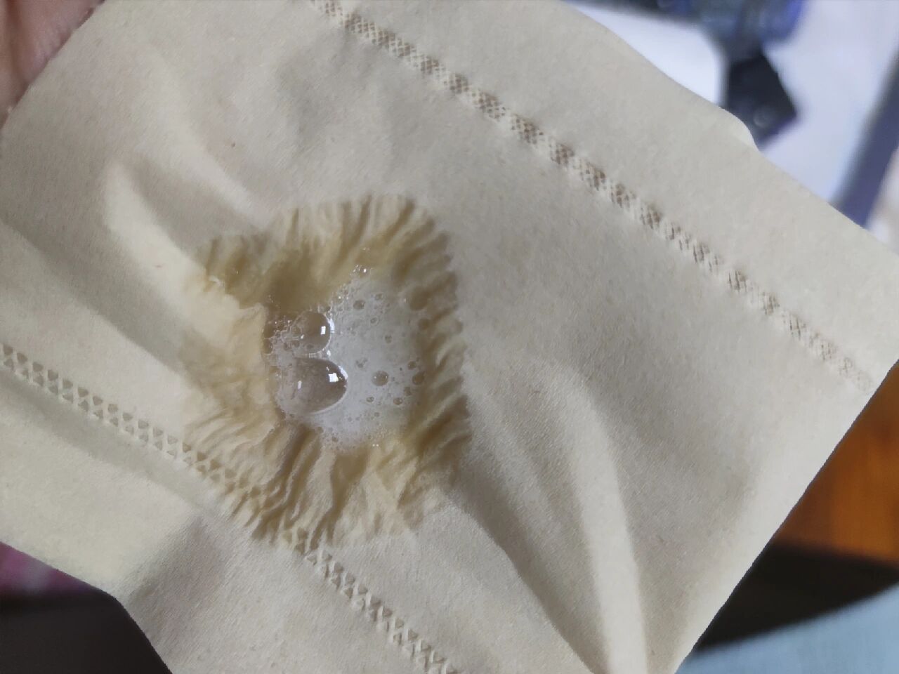 新冠第九天白色泡沫痰,肺少量积液