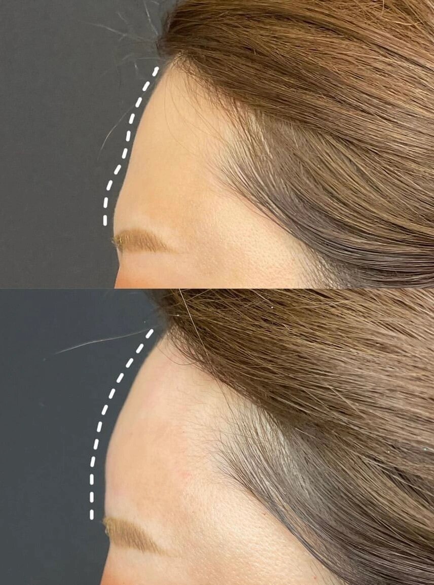 看看我的富贵额头天庭饱满就是有福气