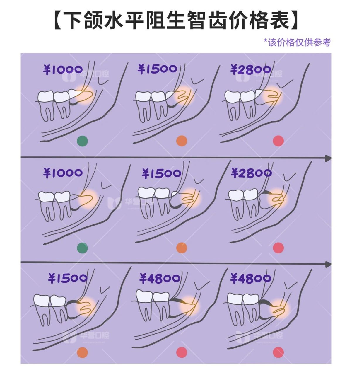 智齿拔牙费用(参考) 智齿长得越歪的,拔除费用越贵; 智齿与下颌神经管
