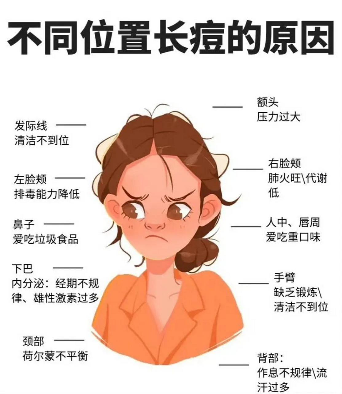 "身体不同部位长痘的原因"