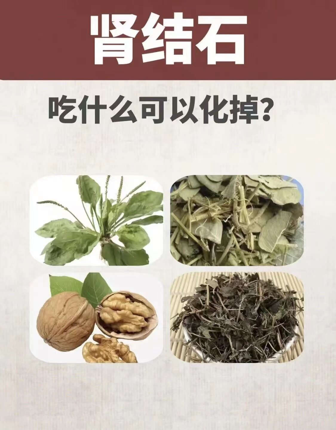肾结石属"石淋""沙淋",因为湿热蕴结下焦,造成肾脏,膀胱气化不利