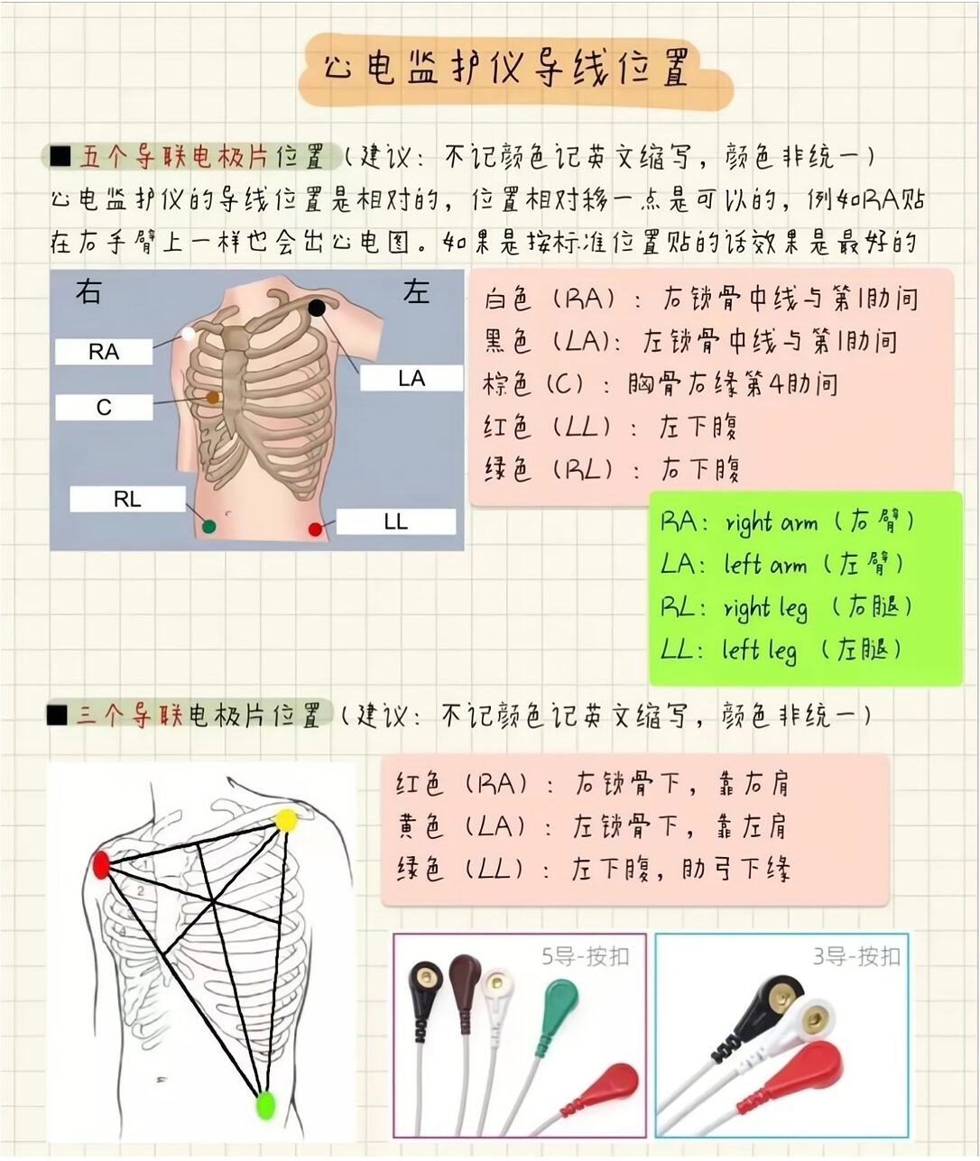 心电图安放位置图片